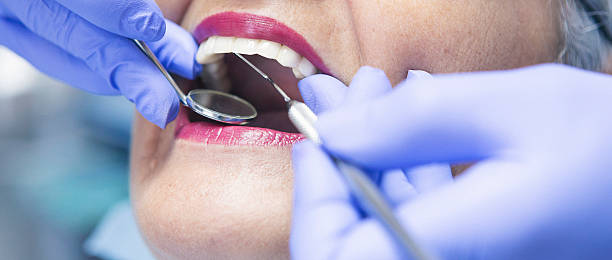 Best Emergency Dental Care for Abscessed Tooth in Glendale, WI
